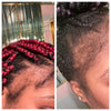 Hair Trifecta- For Hairloss & Dandruff
