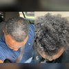 Hair Trifecta- For Hairloss & Dandruff