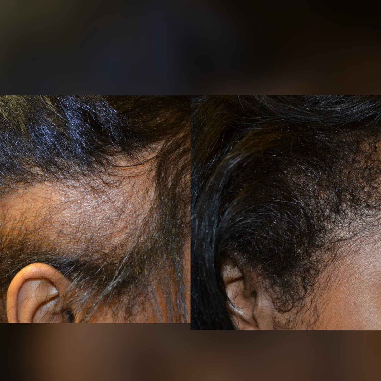 Hair Growth Bundle