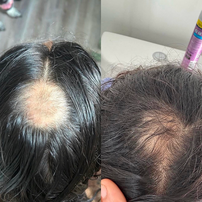 Mega Gro Hair Serum-For Hair Growth
