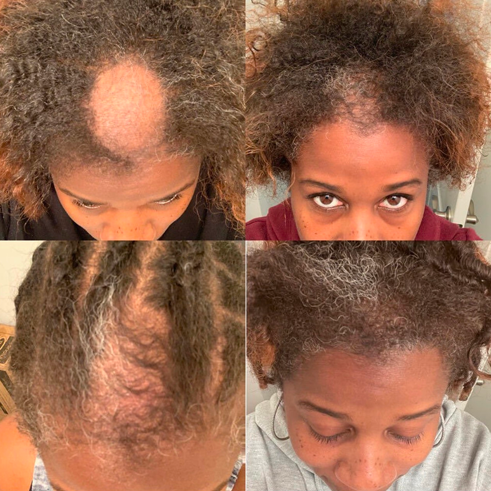 Mega Gro Hair Serum-For Hair Growth