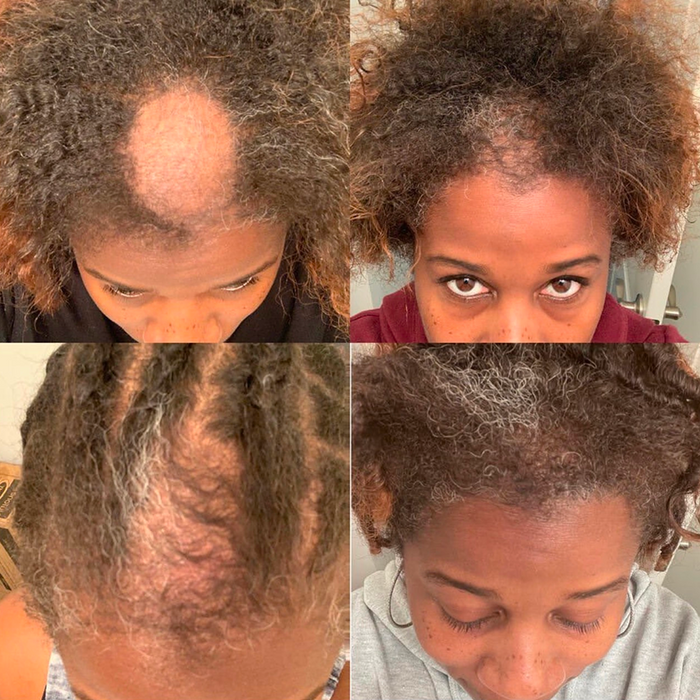 Mega Gro Hair Serum-For Hair Growth