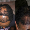 Mega Gro Hair Serum-For Hair Growth