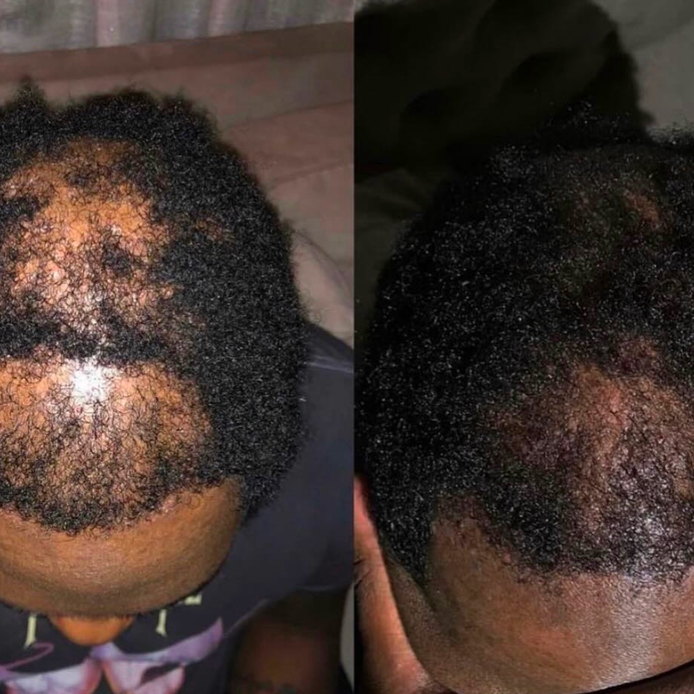 Mega Gro Hair Serum-For Hair Growth