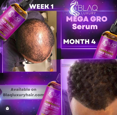 Hair Growth Bundle