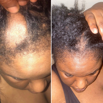Mega Gro Hair Serum-For Hair Growth